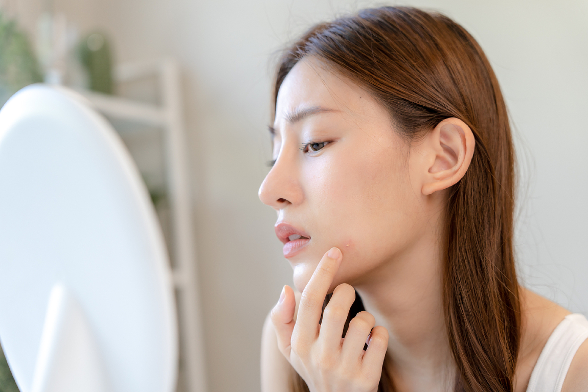 The Perfect Face Routine for Clear, Acne-Free Skin