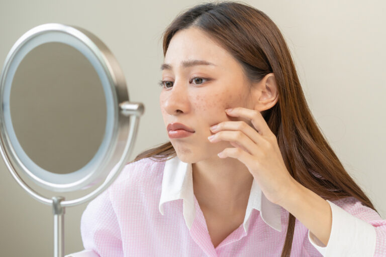 How to Reduce Dark Spots and Achieve an Even Skin Tone